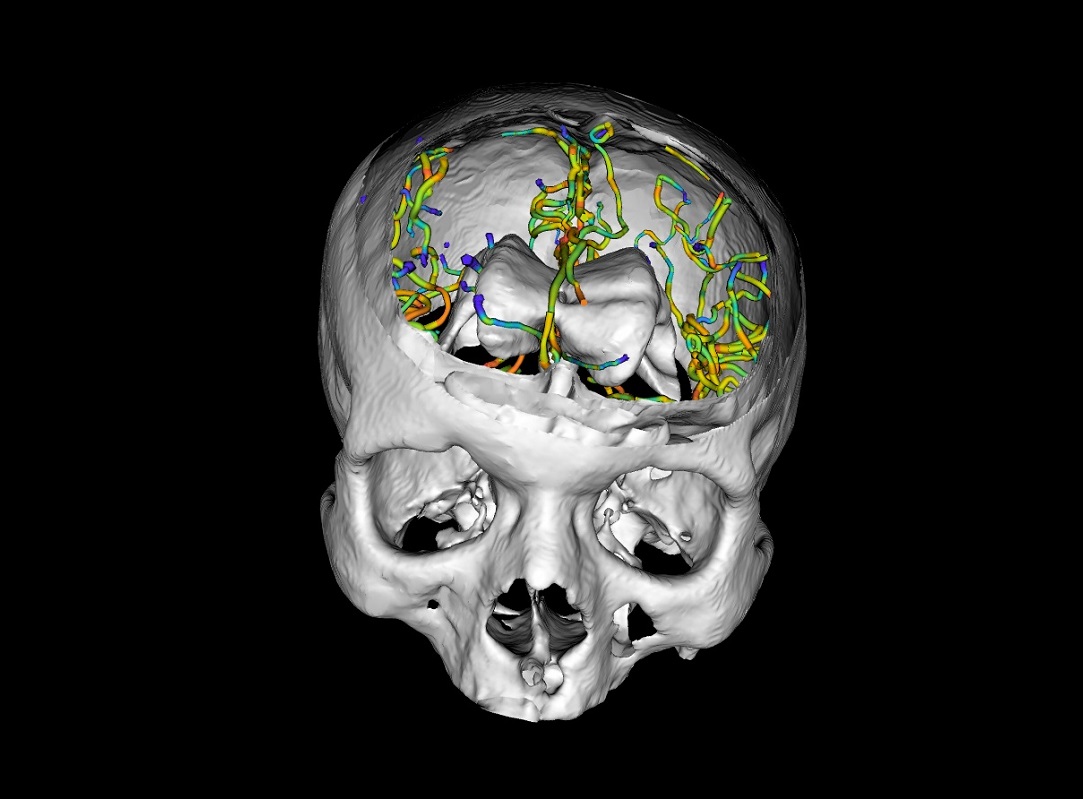 GeometryViewer Brain Blood Vessels