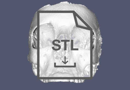 STLReader