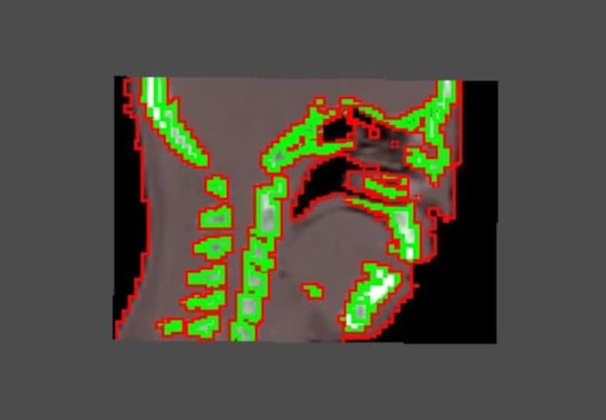 VolumeOutline